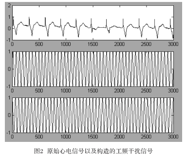 原始心電信號以及所構(gòu)造的工頻干擾信號