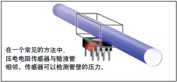 采用低功耗壓阻檢測IC設計便攜式輸液泵