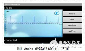 心電圖
