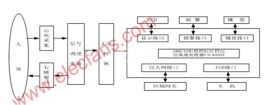 便攜式遠程心電監測儀結構和原理圖