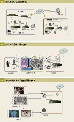 交互式醫學遠程會診系統