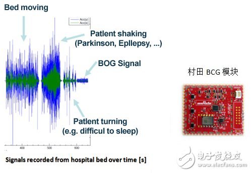 村田智能BCG方案，打造主動(dòng)健康監(jiān)測