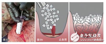 【盤點】2015十大醫療黑科技