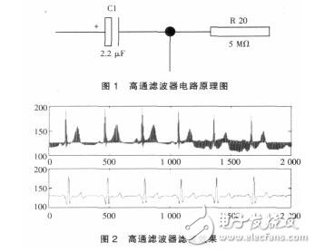 心電信號濾波器的設計