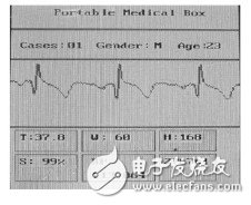  基于STM32的便攜體檢裝置的設計與實現(xiàn)