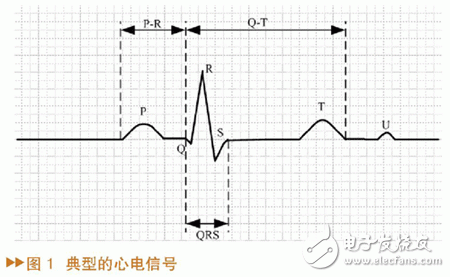 如何設計一個基于MATLAB/SIMULINK的心電信號仿真方法？