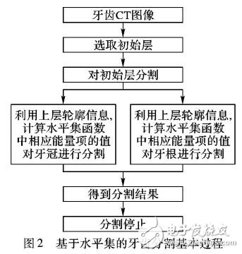 基于水平集的牙齒CT圖像分割技術