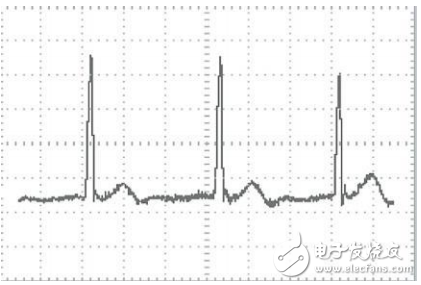基于STM32芯片和TFT-LCD的便攜式心電圖儀設計