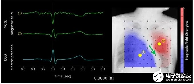 MR生物磁性傳感器的特點(diǎn)以及各種應(yīng)用解析