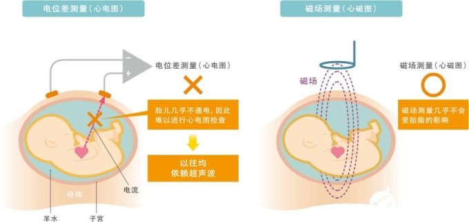 MR生物磁性傳感器的特點(diǎn)以及各種應(yīng)用解析